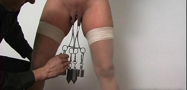  Bound labia with needles